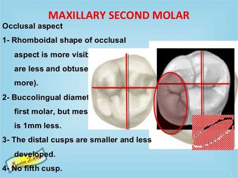 Second maxillary molar (part 1) .